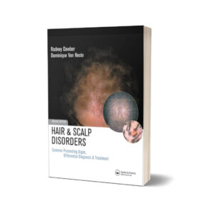 Hair and Scalp Disorders Common Presenting Signs Differential Diagnosis